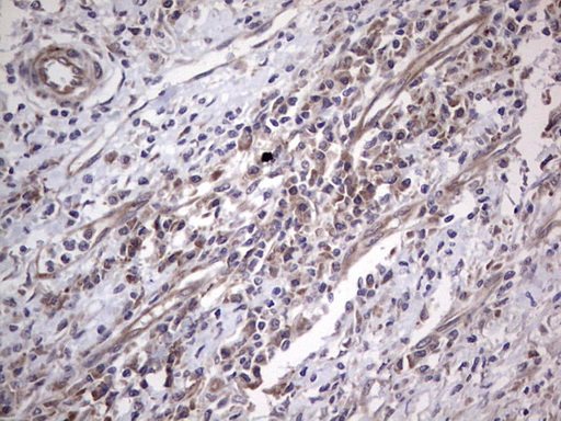 IHC of paraffin-embedded Human colon tissue using anti-NUDT12 mouse monoclonal antibody. (Heat-induced epitope retrieval by 1 mM EDTA in 10mM Tris, pH8.5, 120°C for 3min).