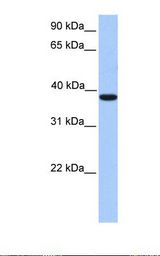 Fetal liver lysate. Antibody concentration: 1.0 ug/ml. Gel concentration: 12%.