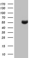 HEK293T cells were transfected with the pCMV6-ENTRY control (Left lane) or pCMV6-ENTRY NUDT12 (Right lane) cDNA for 48 hrs and lysed. Equivalent amounts of cell lysates (5 ug per lane) were separated by SDS-PAGE and immunoblotted with anti-NUDT12.