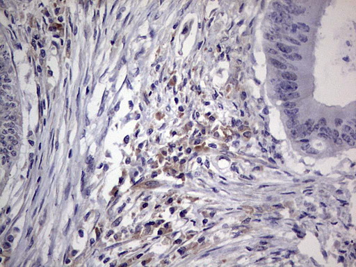 IHC of paraffin-embedded Human colon tissue using anti-NUDT12 mouse monoclonal antibody. (Heat-induced epitope retrieval by 1 mM EDTA in 10mM Tris, pH8.5, 120°C for 3min).