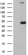 HEK293T cells were transfected with the pCMV6-ENTRY control (Left lane) or pCMV6-ENTRY NUDT12 (Right lane) cDNA for 48 hrs and lysed. Equivalent amounts of cell lysates (5 ug per lane) were separated by SDS-PAGE and immunoblotted with anti-NUDT12.