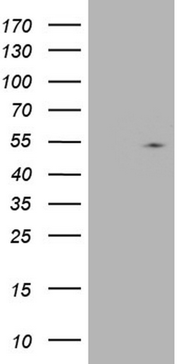 HEK293T cells were transfected with the pCMV6-ENTRY control (Left lane) or pCMV6-ENTRY NUDT12 (Right lane) cDNA for 48 hrs and lysed. Equivalent amounts of cell lysates (5 ug per lane) were separated by SDS-PAGE and immunoblotted with anti-NUDT12.