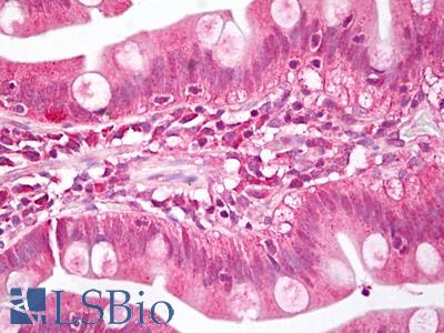 Anti-MEIS1 antibody IHC of human small intestine. Immunohistochemistry of formalin-fixed, paraffin-embedded tissue after heat-induced antigen retrieval. Antibody LS-B7807 dilution 10 ug/ml.