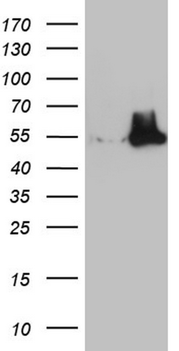 HEK293T cells were transfected with the pCMV6-ENTRY control (Left lane) or pCMV6-ENTRY NUDT12 (Right lane) cDNA for 48 hrs and lysed. Equivalent amounts of cell lysates (5 ug per lane) were separated by SDS-PAGE and immunoblotted with anti-NUDT12.
