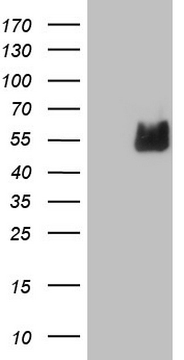 HEK293T cells were transfected with the pCMV6-ENTRY control (Left lane) or pCMV6-ENTRY NUDT12 (Right lane) cDNA for 48 hrs and lysed. Equivalent amounts of cell lysates (5 ug per lane) were separated by SDS-PAGE and immunoblotted with anti-NUDT12.