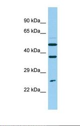 Western blot of Human ACHN. NUDT14 antibody dilution 1.0 ug/ml.