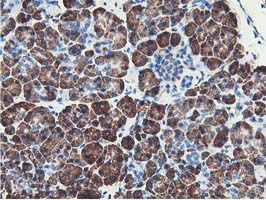 IHC of paraffin-embedded Human pancreas tissue using anti-NUDT18 mouse monoclonal antibody.
