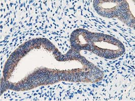 IHC of paraffin-embedded Human endometrium tissue using anti-NUDT18 mouse monoclonal antibody.