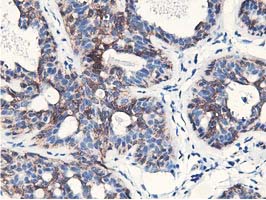 IHC of paraffin-embedded Human breast tissue using anti-NUDT18 mouse monoclonal antibody.