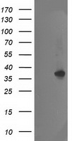 HEK293T cells were transfected with the pCMV6-ENTRY control (Left lane) or pCMV6-ENTRY NUDT18 (Right lane) cDNA for 48 hrs and lysed. Equivalent amounts of cell lysates (5 ug per lane) were separated by SDS-PAGE and immunoblotted with anti-NUDT18.