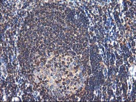 IHC of paraffin-embedded Human tonsil using anti-NUDT18 mouse monoclonal antibody.
