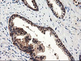IHC of paraffin-embedded Human prostate tissue using anti-NUDT18 mouse monoclonal antibody.
