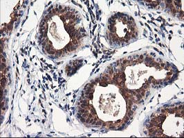 IHC of paraffin-embedded Human breast tissue using anti-NUDT18 mouse monoclonal antibody.