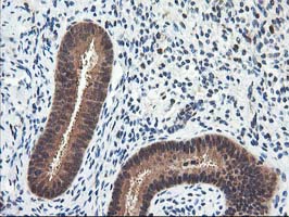 IHC of paraffin-embedded Human endometrium tissue using anti-NUDT18 mouse monoclonal antibody.
