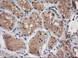 IHC of paraffin-embedded Human Kidney tissue using anti-NUDT18 mouse monoclonal antibody.