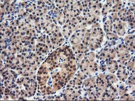 IHC of paraffin-embedded Human pancreas tissue using anti-NUDT18 mouse monoclonal antibody.