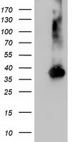 HEK293T cells were transfected with the pCMV6-ENTRY control (Left lane) or pCMV6-ENTRY NUDT18 (Right lane) cDNA for 48 hrs and lysed. Equivalent amounts of cell lysates (5 ug per lane) were separated by SDS-PAGE and immunoblotted with anti-NUDT18.
