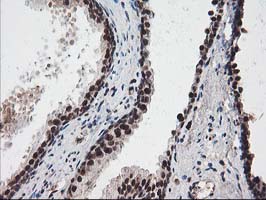 IHC of paraffin-embedded Human prostate tissue using anti-NUDT18 mouse monoclonal antibody.