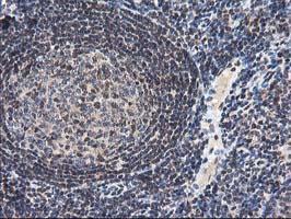 IHC of paraffin-embedded Human tonsil using anti-NUDT18 mouse monoclonal antibody.