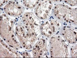 IHC of paraffin-embedded Human Kidney tissue using anti-NUDT18 mouse monoclonal antibody.