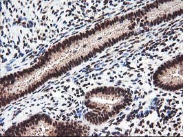 IHC of paraffin-embedded Human endometrium tissue using anti-NUDT18 mouse monoclonal antibody.