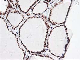 IHC of paraffin-embedded Human thyroid tissue using anti-NUDT18 mouse monoclonal antibody.