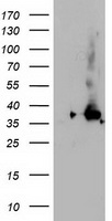 HEK293T cells were transfected with the pCMV6-ENTRY control (Left lane) or pCMV6-ENTRY NUDT18 (Right lane) cDNA for 48 hrs and lysed. Equivalent amounts of cell lysates (5 ug per lane) were separated by SDS-PAGE and immunoblotted with anti-NUDT18.