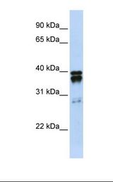 293T cell lysate. Antibody concentration: 1.0 ug/ml. Gel concentration: 12%.