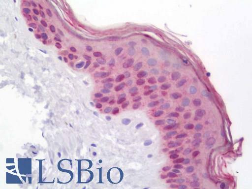 Anti-MEIS1 antibody IHC staining of human skin. Immunohistochemistry of formalin-fixed, paraffin-embedded tissue after heat-induced antigen retrieval. Antibody LS-B11422 concentration 20 ug/ml.