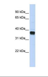 Transfected 293T cell lysate. Antibody concentration: 1.0 ug/ml. Gel concentration: 12%.