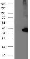 HEK293T cells were transfected with the pCMV6-ENTRY control (Left lane) or pCMV6-ENTRY NUDT18 (Right lane) cDNA for 48 hrs and lysed. Equivalent amounts of cell lysates (5 ug per lane) were separated by SDS-PAGE and immunoblotted with anti-NUDT18.