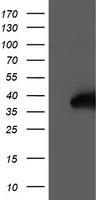 HEK293T cells were transfected with the pCMV6-ENTRY control (Left lane) or pCMV6-ENTRY NUDT18 (Right lane) cDNA for 48 hrs and lysed. Equivalent amounts of cell lysates (5 ug per lane) were separated by SDS-PAGE and immunoblotted with anti-NUDT18.