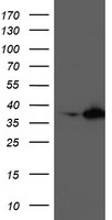 HEK293T cells were transfected with the pCMV6-ENTRY control (Left lane) or pCMV6-ENTRY NUDT18 (Right lane) cDNA for 48 hrs and lysed. Equivalent amounts of cell lysates (5 ug per lane) were separated by SDS-PAGE and immunoblotted with anti-NUDT18.
