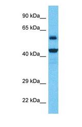 Western blot of NUDT19 Antibody with human RPMI-8226 Whole Cell lysate.