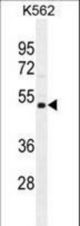 NUDT19 Antibody western blot of K562 cell line lysates (35 ug/lane). The NUDT19 antibody detected the NUDT19 protein (arrow).