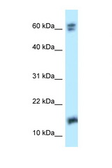 NUDT2 antibody LS-C145948 Western blot of 293T Cell lysate. Antibody concentration 1 ug/ml.