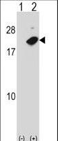 Western blot of NUDT2 (arrow) using rabbit polyclonal NUDT2 Antibody. 293 cell lysates (2 ug/lane) either nontransfected (Lane 1) or transiently transfected (Lane 2) with the NUDT2 gene.