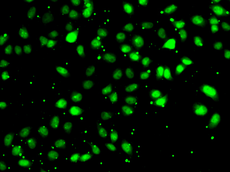 Immunofluorescence blot of HeLa cell using NUDT2 antibody.