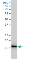 NUDT2 monoclonal antibody (M01), clone 4A4-3C3 Western Blot analysis of NUDT2 expression in Jurkat.