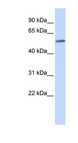 MEIS2 antibody LS-C109953 Western blot of MCF7 cell lysate.