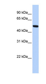 MEIS2 antibody LS-C110135 Western blot of Jurkat lysate.