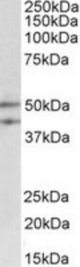 MEIS2 antibody (0.3 ug/ml) staining of Rat Thymus lysate (35 ug protein/ml in RIPA buffer). Primary incubation was 1 hour. Detected by chemiluminescence.