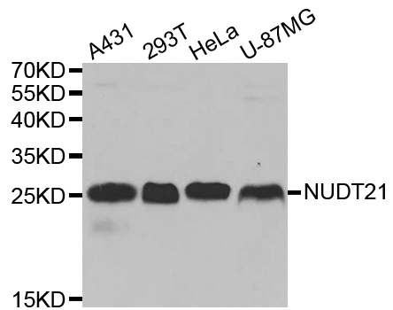 Western blot analysis of extracts of various cell lines, using NUDT21 antibody.