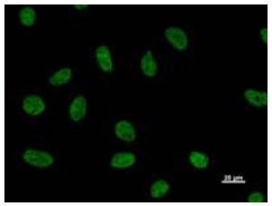 Immunofluorescent staining using NUDT21 antibody. Immunostaining analysis in HeLa cells. HeLa cells were fixed with 4% paraformaldehyde and permeabilized with 0.01% Triton-X100 in PBS. The cells were immunostained with anti-NUDT21 antibody.