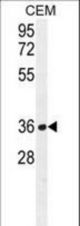 NUDT22 Antibody western blot of CEM cell line lysates (35 ug/lane). The NUDT22 antibody detected the NUDT22 protein (arrow).