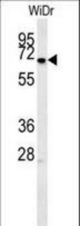 MEIS2 Antibody (Center D269) western blot of WiDr cell line lysates (15 ug/lane). The MEIS2 antibody detected the MEIS2 protein (arrow).