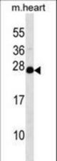 NUDT4 Antibody western blot of mouse heart tissue lysates (35 ug/lane). The NUDT4 antibody detected the NUDT4 protein (arrow).