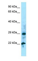 NUDT5 antibody Western Blot of 721_B.