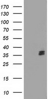 HEK293T cells were transfected with the pCMV6-ENTRY control (Left lane) or pCMV6-ENTRY NUDT6 (Right lane) cDNA for 48 hrs and lysed. Equivalent amounts of cell lysates (5 ug per lane) were separated by SDS-PAGE and immunoblotted with anti-NUDT6.