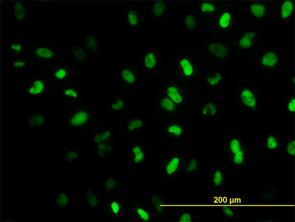 Immunofluorescence of monoclonal antibody to MEIS2 on HeLa cell. [antibody concentration 10 ug/ml]